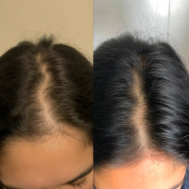 Sarah M., 47 | Wegovy