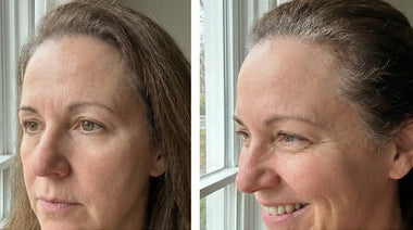 Linda T., 55 | Compound GLP-1