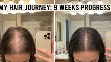 Michelle R., 49 | Mounjaro